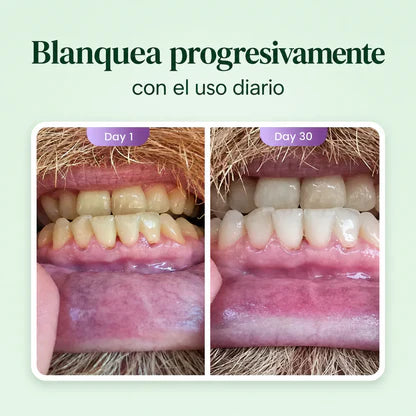 EVOLUX™ – Pasta Dental de Fórmula Avanzada | Elimina el Mal Aliento, Blanqueado Natural Progresivo